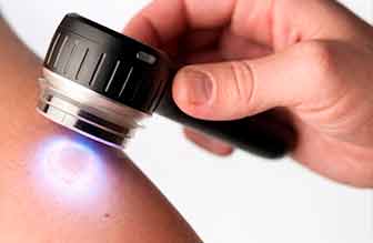Avaliação clínica da pele com dermatoscópio