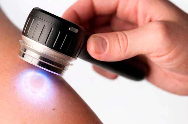 Exame dermatológico da pele com dermatoscópio